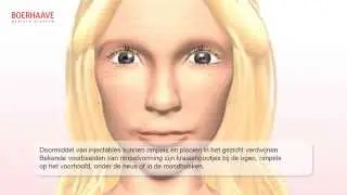 Fillers en Botox Animatie - Boerhaave Medisch Centrum