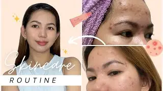 SKINCARE ROUTINE / How I cleared (almost) my face from acne / Oilly-Acne-prone-sensitive skin ✨