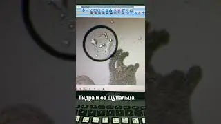 Гидра- двухслойные животные. Живут в пресных водоемах и хищники по своей природе🦈   #гидра