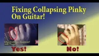 Collapsing Pinky on Guitar - Fix with this Pinky Finger Exercise #guitarexercises,#guitarpractice,