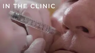 Freshen and Restore Face Volume of 60-Year-Old | In The Clinic: Before and Afters