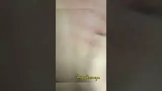 Kerokan wanita cantik kulit putih‼️scrapings of beautiful white women 
