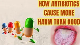8 REASONS To not Take ANTIBIOTICS Unless NEEDED | The HARMFUL effects of Antibiotics