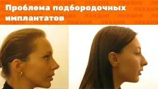 The Main Problem with Chin Implants