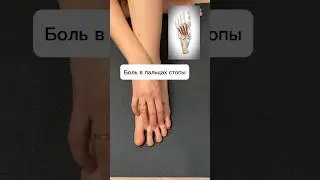 Боль в пальцах стопы со 2-го по 4-й Тыльные межкостные мышцы #Рекомендации #Shorts #здоровье