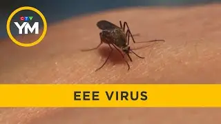 What is Eastern Equine Encephalitis (EEE) Virus? | Your Morning
