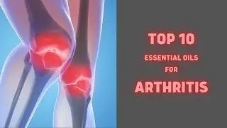 Top 10 Essential Oils For Arthritis | Health Tips | Sky world