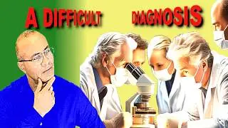 Ankylosing Spondylitis (The Concealed Struggle Behind A Diagnosis)