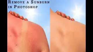 How to Remove Sunburn in Photoshop