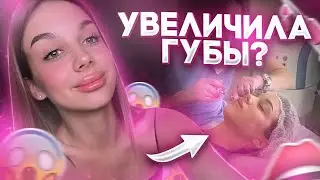 МОЯ ИСТОРИЯ УВЕЛИЧЕНИЯ ГУБ | БЫЛО БОЛЬНО ???