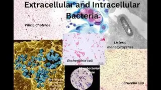 Classification of Bacteria based on Intracellular or Extracellular Existence