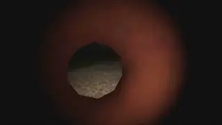 Странная Горка — 