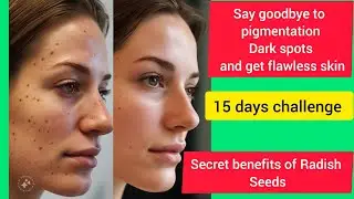 The Magical Cure for Pigmentation and Dark spots?🤷‍♀️|Radish Seeds| #skincare #youtube #pigmentation