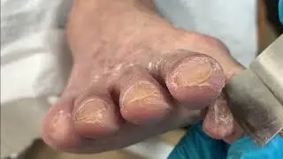 A pair of old feet, the feet of low-level laborers【TD Foot care】