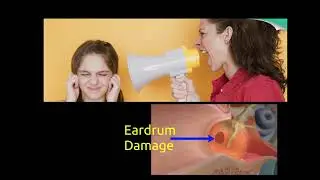 Noise Pollution: Effects and Prevention