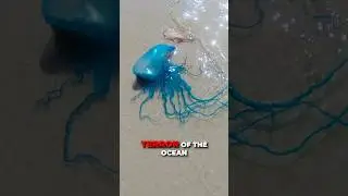 PAINFUL Jellyfish Sting and How to Fix it!