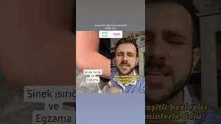ANNE SÜTÜNE DİKKAT 🙄