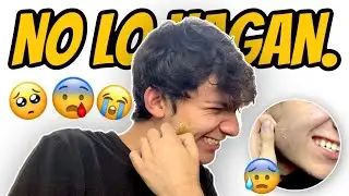 NO SE DEPILEN LA CARA CON CERA *SALIÓ MAL*