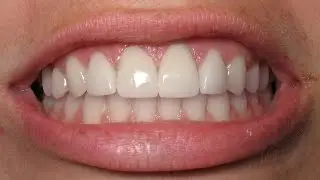 How to whiten teeth in photoshop. Как отбелить зубы в фотошопе