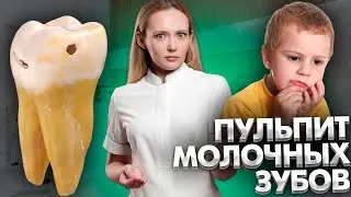 Лечение пульпита молочных зубов у детей. Клинический случай