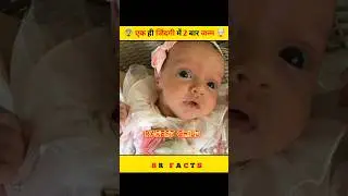 😨Rarest child🤯 एक ही life में 2 बार जन्म 🥵 #viralvideo #viral #shorts