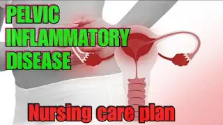 PELVIC INFLAMMATORY DISEASE (PID) || CARE PLAN #nursingschoolstudents #nursingcareplan #education