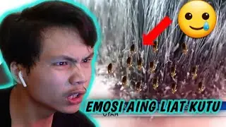 KUTU TERBANYAK DI RAMBUT PRIA BIKIN EMOSI !! 😬😬