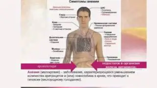 Как избавиться от анемии с помощью продукции Арт Лайф.
