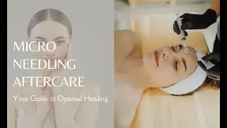 Essential Micro Needling Aftercare: Your Guide to Optimal Healing