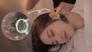 Ear Cleaning While Watching ASMR 👂| Endoscope, Cutter, Peacock Feather, Cotton | Visual Ear Cleaning