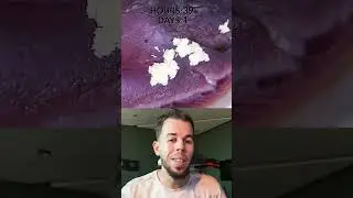 قلب الخنزير VS الزمن ⏱️