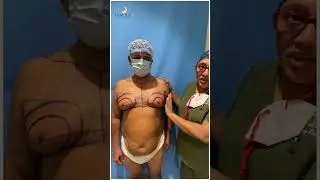 Gynecomastia Recorrection Surgery | Tamiralife Chennai | Dr. Jayanthy Ravindran