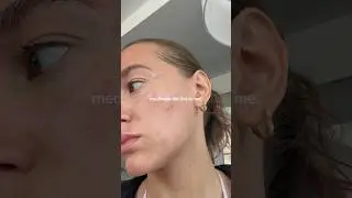 do not use medicube if you have oily/combination skin 