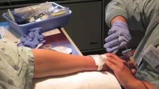 MY 31ST SURGERY (#950 / 8-7-13)
