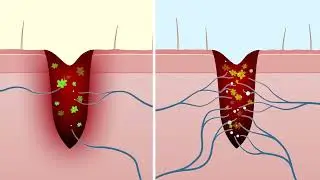 Monash Calcitonin Gene-Related Peptide (CGRP) Animation