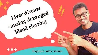 Liver disease causes deranged blood clotting - WHY??