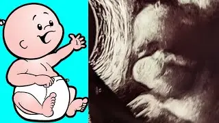 First Glimpse of My Baby! 👶36w 6d Growth Ultrasound🧒Adoption Journey