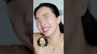 Da của bạn có thật sự cần mỹ phẩm cấp ẩm??? #viral #bacsidalieu #bacsihang #serum