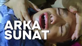 Arka Minta Sunat, Malah Drama