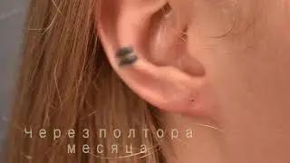 Зашивание тоннелей