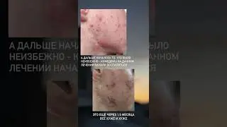 История пациента 