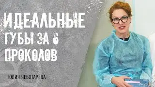 💋Безопасная контурная пластика губ: процесс и результат. Контурная пластика губ процесс. ЭСТЕЛАБ.12+