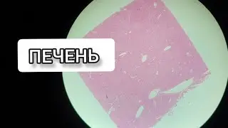 LIVER