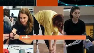 AI-Powered Bionic Limbs: Transforming Lives & Restoring Independence | Cogent Innovations