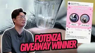 Potenza Microneedling Treatment Experience: Giveaway Winner | Ang Chee at RJ Clinic