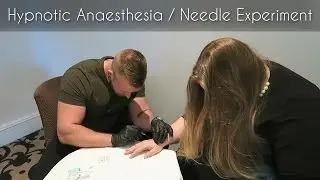 Hypnotic Anaesthesia - The Needle Experiment