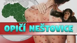 Opičí neštovice - Historie, příznaky a šíření mimo Afriku