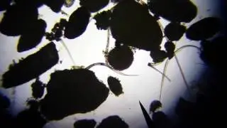 Ciliate and dinoflagellates