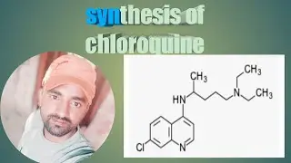 Synthesis of chloroquine