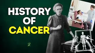 The 4000-Year History of Cancer You Never Knew